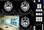 Exames mais complexos como tomografias e ressonncias magnticas j integram o sistema