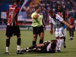 Goleiro Fabiano sente a perna e jogo  paralisado