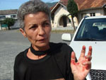 Mulher ferida por participantes da puxada.