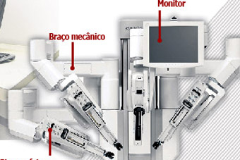 Como funciona um cirurgião robô