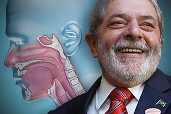 Câncer de Lula